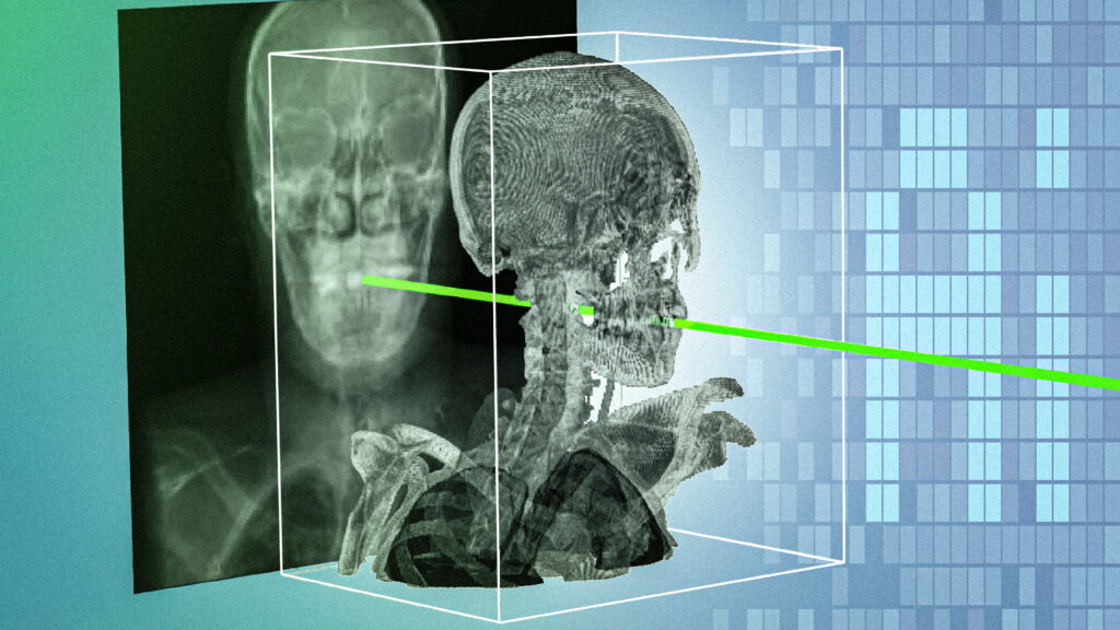 New AI technique could make minimally invasive surgeries safer and more precise | MIT News