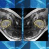 Why teaching AI about symmetry could make prenatal diagnosis more reliable | MIT News